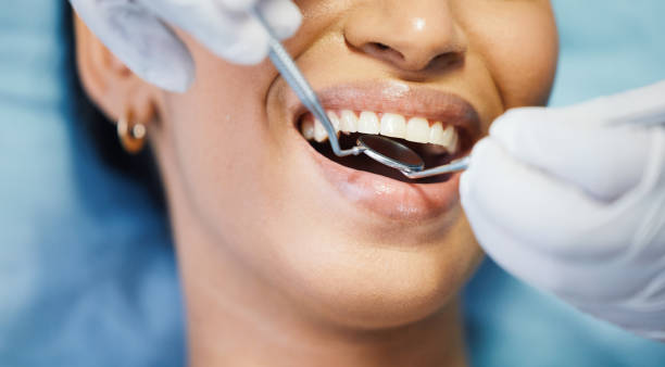 Best Emergency Denture Repair in Bowling Green, MO