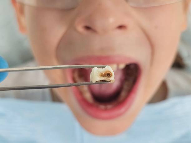 Best Weekend Emergency Dentist in Bowling Green, MO