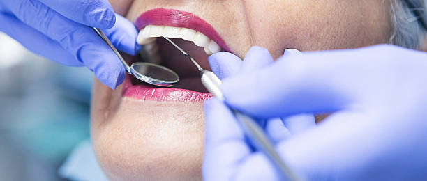 Best Emergency Dental Care for Broken or Chipped Teeth in Bowling Green, MO